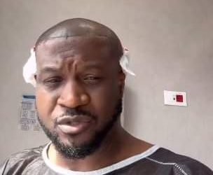 Peter Okoye undergoes hair transplant to eradicate baldness